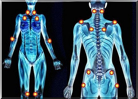 5 early warning signs of fibromyalgia