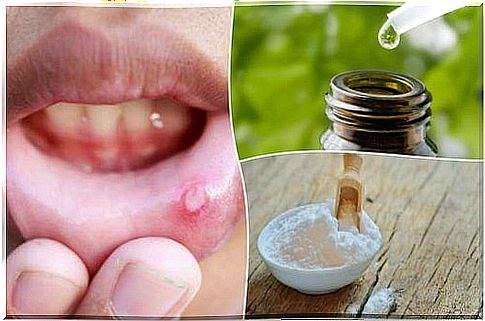 Get relief from after with these 6 natural remedies