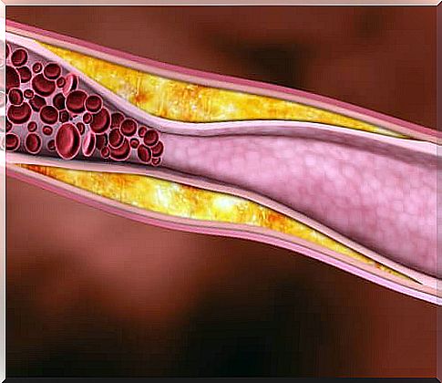 cholesterol