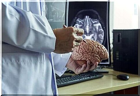 A doctor holding a plastic brain.