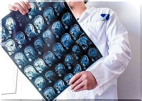 A doctor looking at brain scans.