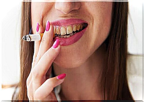 Melanosis in smokers: Symptoms and treatment