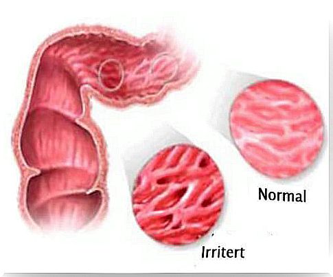 Note!  Prohibited food if you have irritated bowel