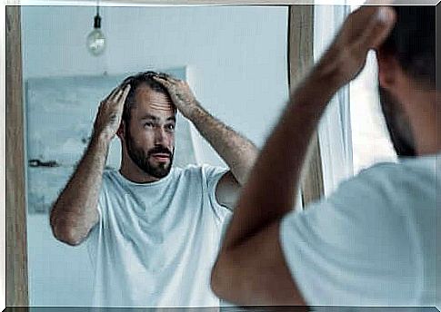 Man with patchy hair loss