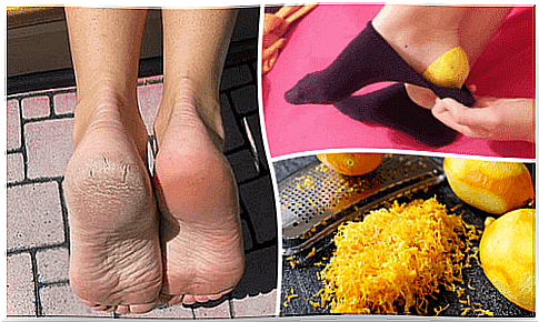 Use lemon peel to take care of your feet